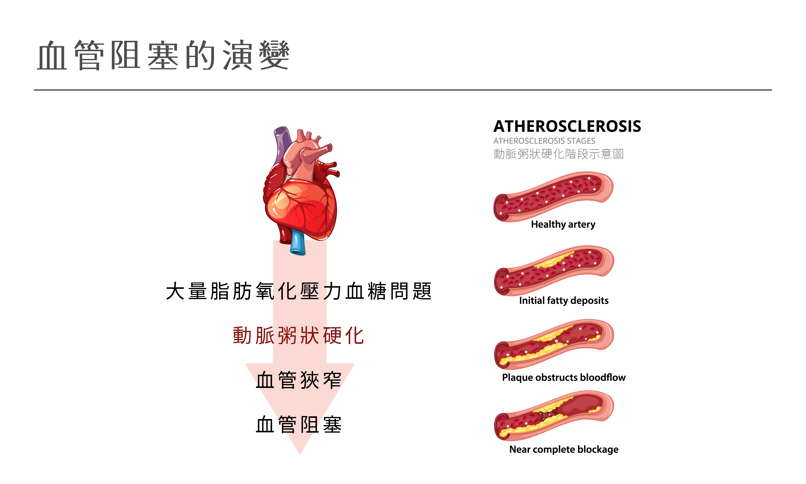 沈默的殺手-心血管疾病- 知識專欄- Nahrin Taiwan 納霖